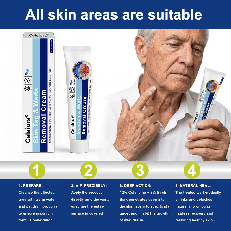 ✨💝Celsiora® Targeted Skin Tag & Wart Removal Cream – Time-Released Phyto-Exfoliant (12% Celandine ) & Bio-Active Terpene Viral-Inhibitor (8% Thuja)