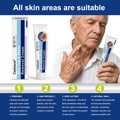 ✨💝Celsiora® Targeted Skin Tag & Wart Removal Cream – Time-Released Phyto-Exfoliant (12% Celandine ) & Bio-Active Terpene Viral-Inhibitor (8% Thuja)