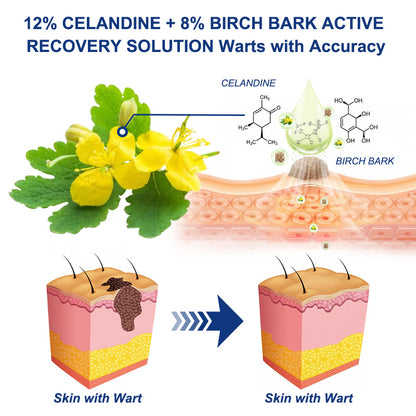✨💝Celsiora® Targeted Skin Tag & Wart Removal Cream – Time-Released Phyto-Exfoliant (12% Celandine ) & Bio-Active Terpene Viral-Inhibitor (8% Thuja)